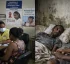 AIDS (Acquired Immunodeficiency Syndrome) in Dominica